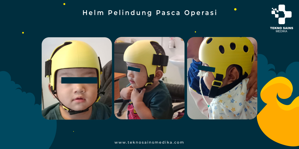 helm pelindung