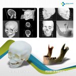 Contoh pengaplikasian GUO3D untuk kasus mandibula