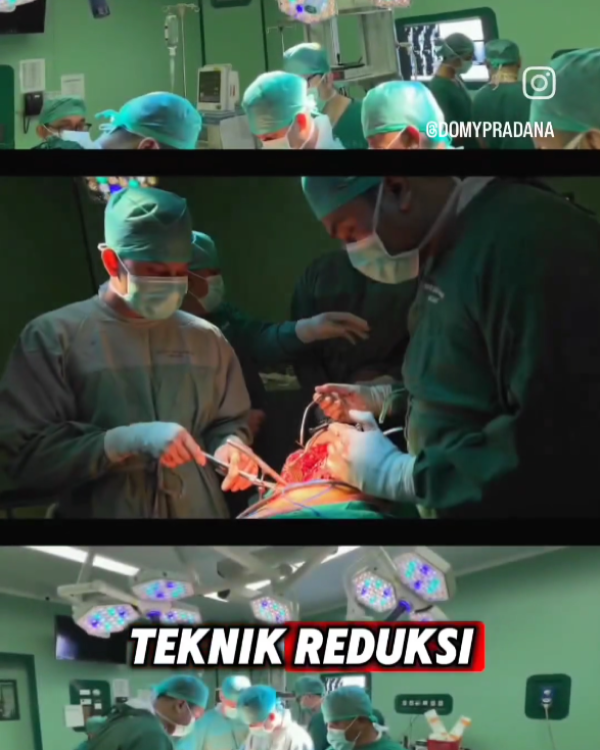 3D Printing for Ortho Surgery by Tekno Sains Medika 5